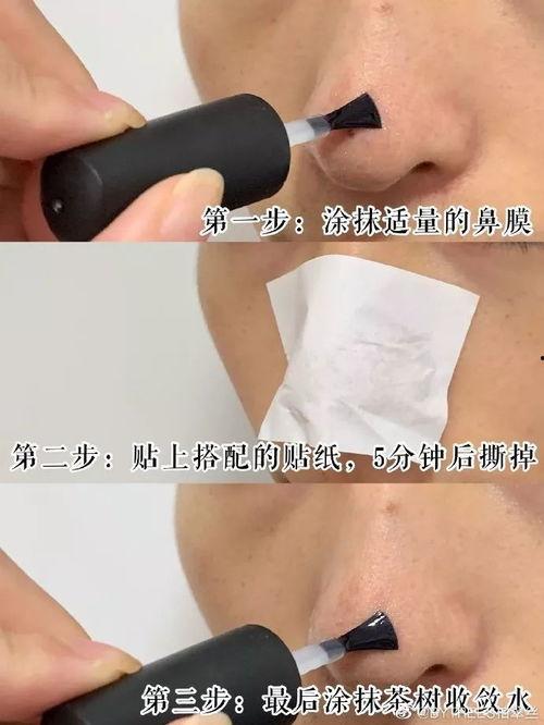 去黑头明星网红,告别毛孔粗大困扰